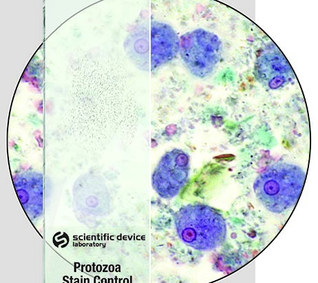 Protozoa Stain Control Slides